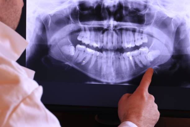 Best Emergency Dentist for Knocked-Out Tooth in Eaton Rapids, MI