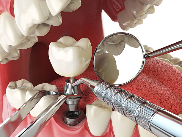 Best Holiday Emergency Dentist in Eaton Rapids, MI