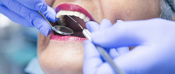 Best Emergency Dentist for Knocked-Out Tooth in Eaton Rapids, MI